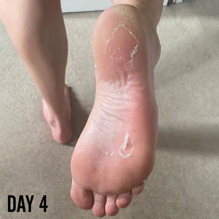 Barber Pro Foot Peel (40g) Hands & Feet Barber Pro