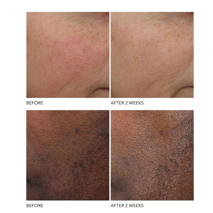 Dr. Dennis Gross Skincare Advanced Retinol + Ferulic Overnight Wrinkle Treatment (30ml) Serums Dr. Dennis Gross