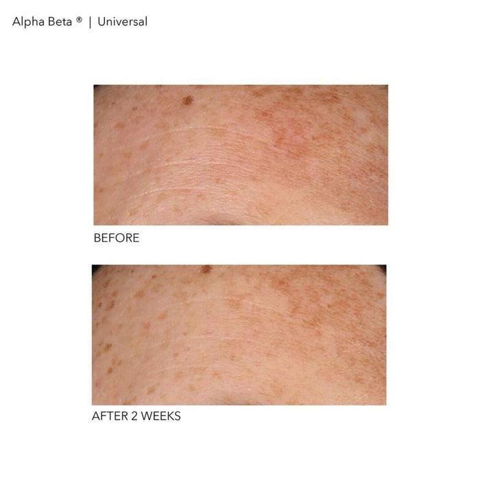 Dr. Dennis Gross Skincare Alpha Beta Universal Daily Peel (30-60 treatments) Pads & Peels Dr. Dennis Gross