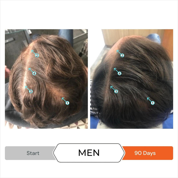 DS Laboratories Revita High Performance Hair-Stimulating Shampoo (Size Options) Shampoos DS Laboratories