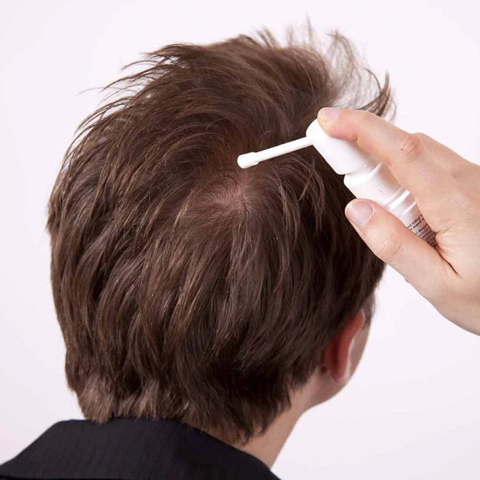 Foligain Men's Intensive Treatment for Thinning Hair with 10% Trioxidil (59ml) Hair Loss Treatments Foligain