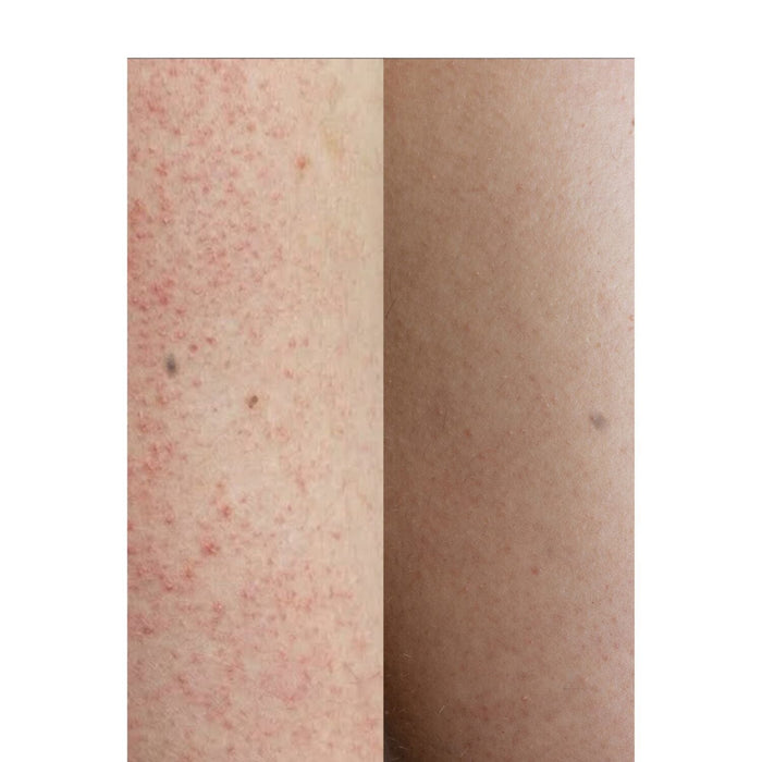 Grown Alchemist Resurfacing Targeted Body Cleanser (300ml) Shower Gels & Washes Grown Alchemist