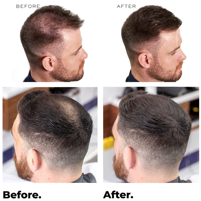 Nanogen Keratin Hair Fibres - 30g (Colour options) Hair Loss Treatments Nanogen